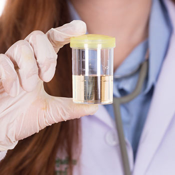 Drug test urine sample